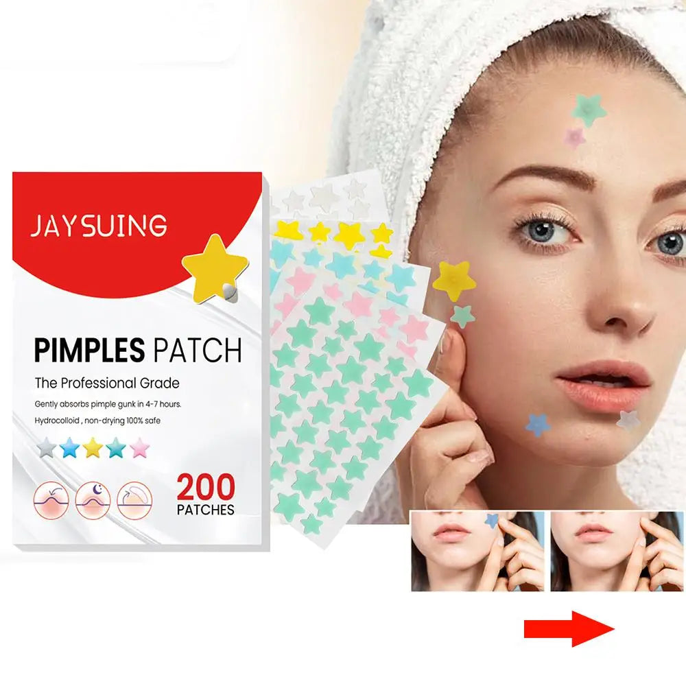 200Pcs Star Pimple Patch Acne Colorful Invisible Acne Removal Skin Care Stickers Face Spot Beauty Makeup Tool Beauty Dropshiping